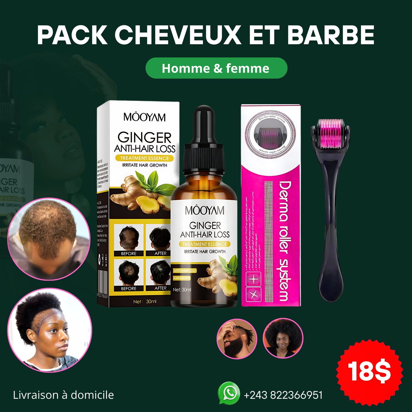 Derma Roller & Huile Ginger - La Solution Complète contre la Chute de Cheveux, l'Alopécie et la Barbe.
